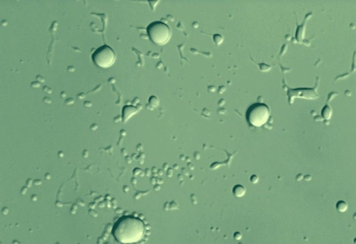 wpid-17196_batterio.jpg