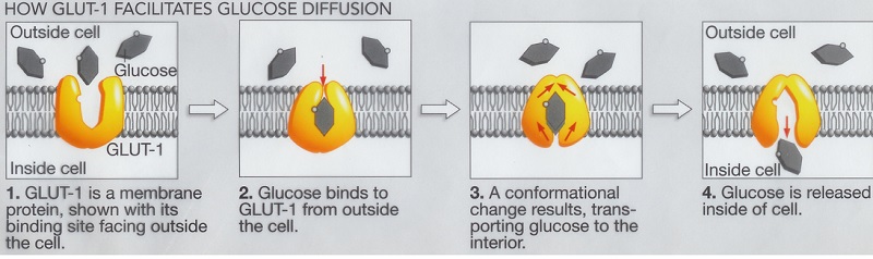 Descrizione del comportamento del glucosio in caso di deficit di Glut1 (Fonte Associazione Italiana Glut1 onlus)